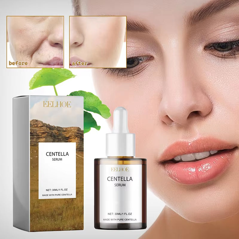 Centella Asiatica Face Serum Moisturizer Nourish Dry Skin Smoothing Rejuvenation Skin Brightening Whitening Cream Facial 2025 